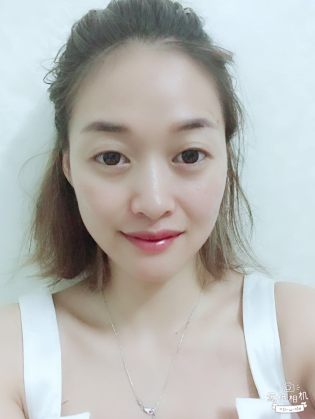 官根凤